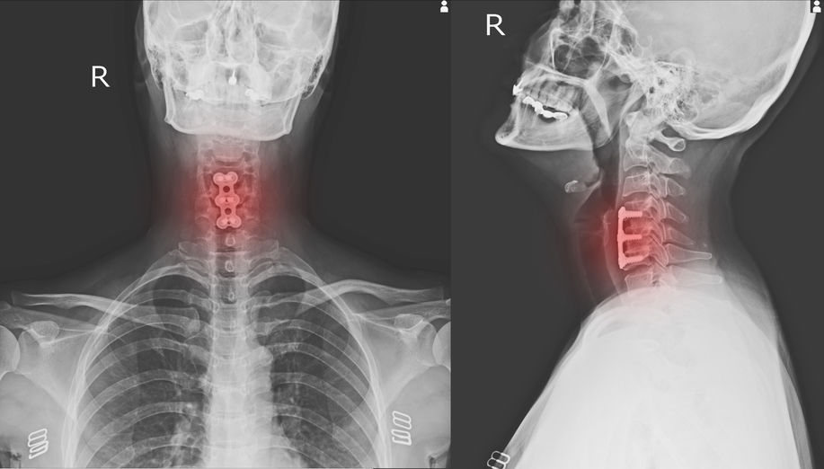 soft tissue injury