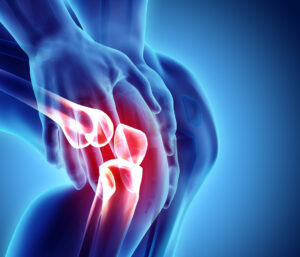 What Can Cause Leg Swelling After a Motorcycle Accident?
