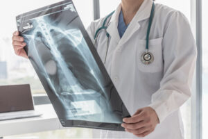 What Is a Thoracic Injury?